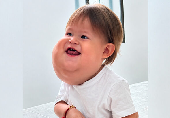 el bebé cucuteño que luchó por atención médica y hoy tiene una nueva esperanza